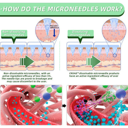 š©āāļøCroaie⢠SMGT-GLP-1 Nano Microneedle Patchļ¼Painless, long-lasting, addressing diabetes, obesity, and cardiovascular diseasesļ¼