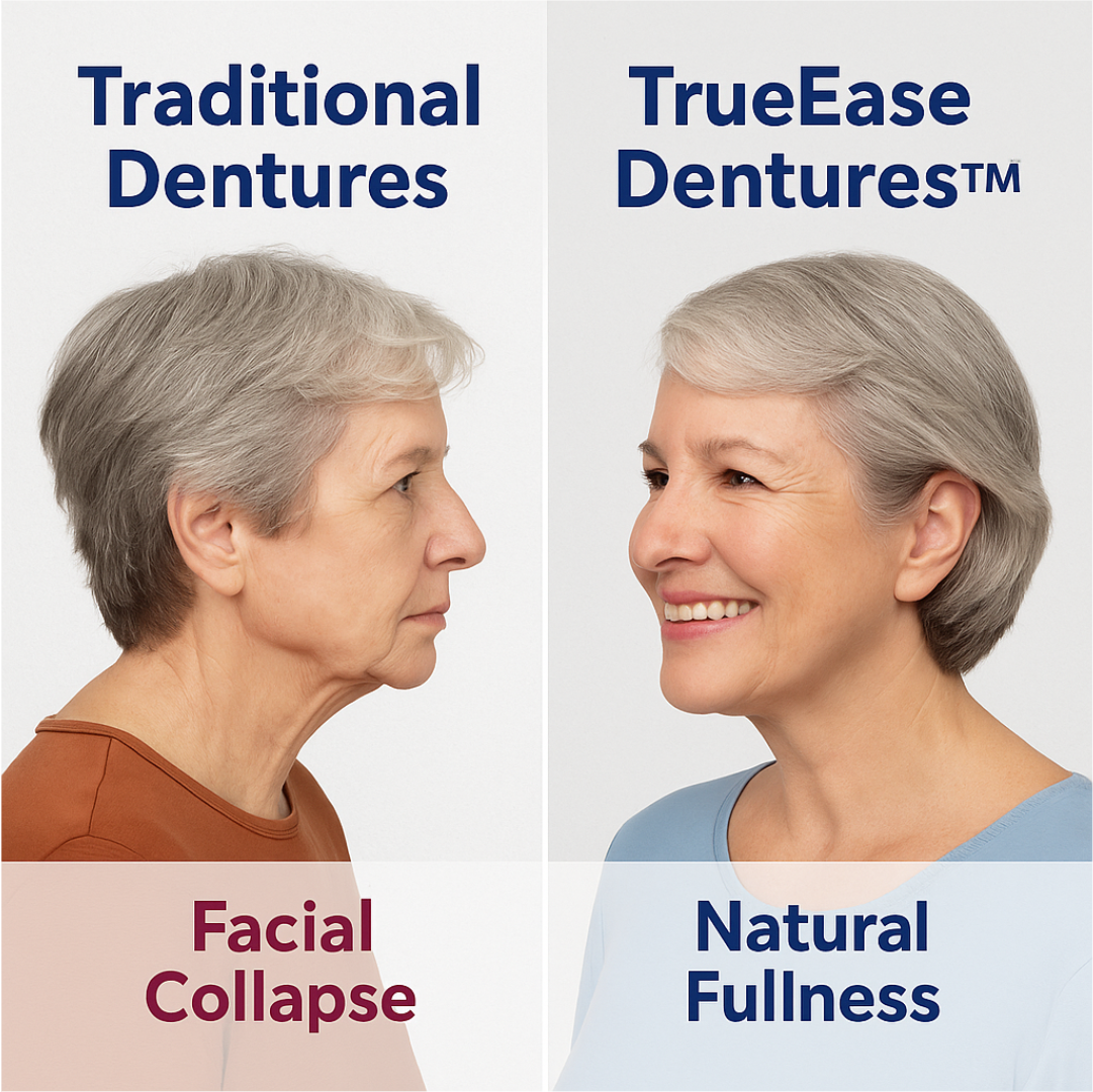 TrueEase™ Custom-Fit Functional Dentures — Perfectly Fitted in Minutes at Home