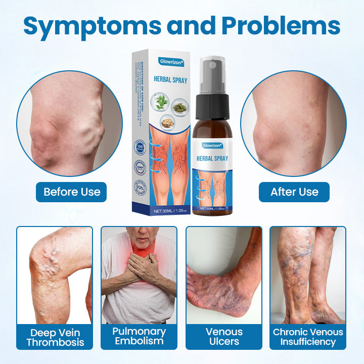 Veinelle® Herbal Spray – Clinically Proven to Visibly Fade Varicose & Spider Veins in Just 7 Days