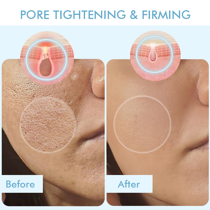 Korean Bio-collagen Real Deep Mask