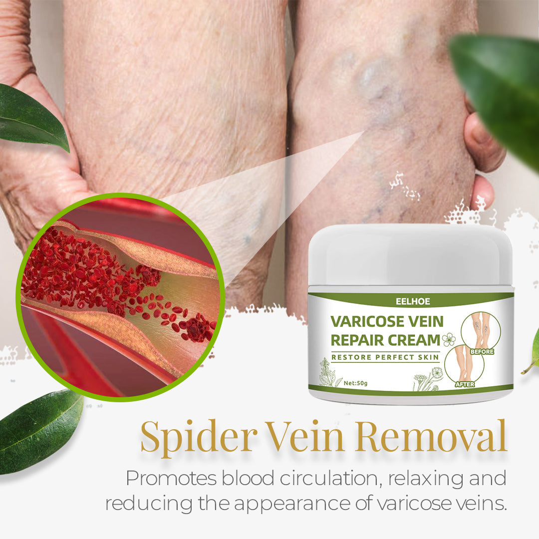 Varicose Vein Cream