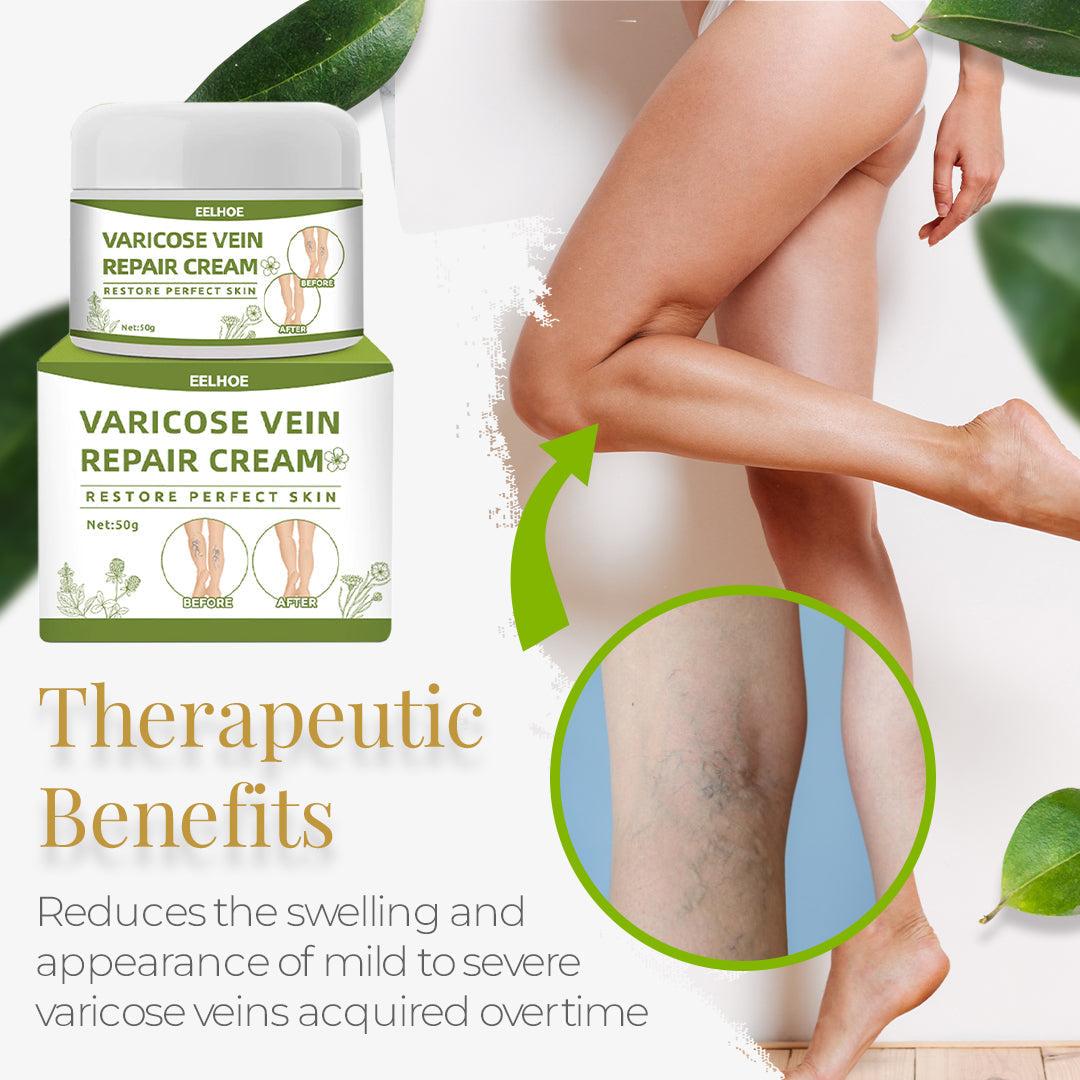 Varicose Vein Cream