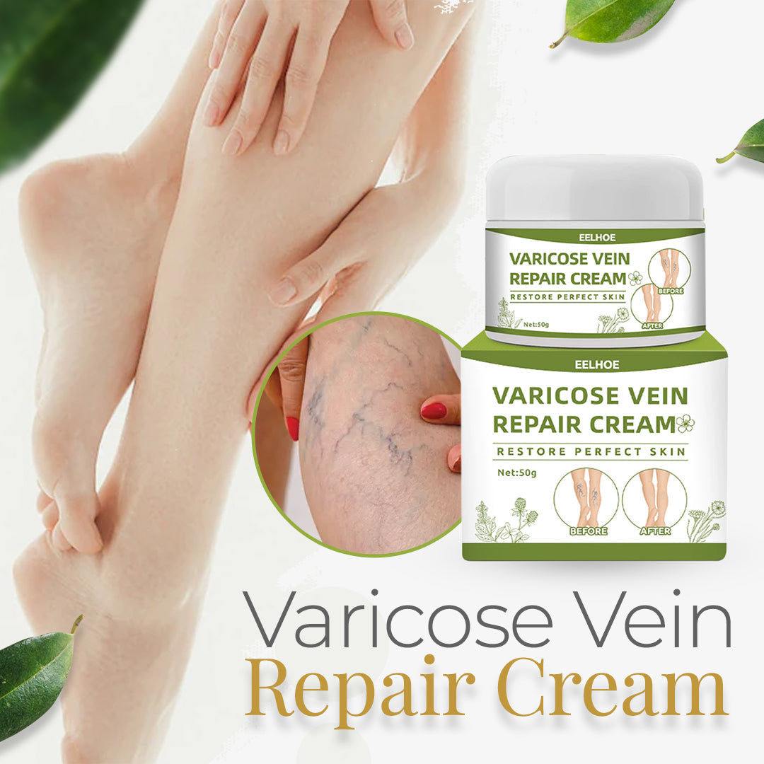 Varicose Vein Cream