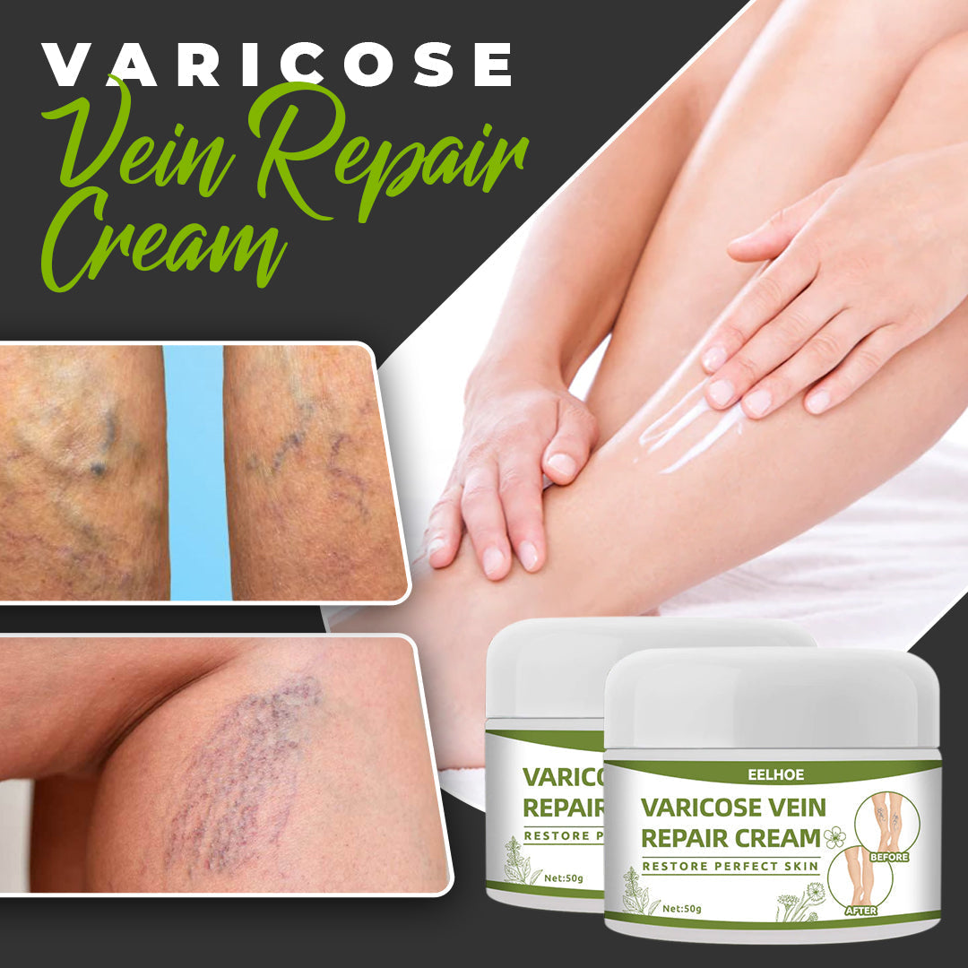 Varicose Vein Cream