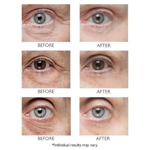 Clinical SkinCare Instant Eye Tightener