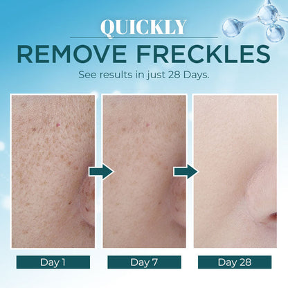 Triple-Active Brightening Dark Spot Remover
