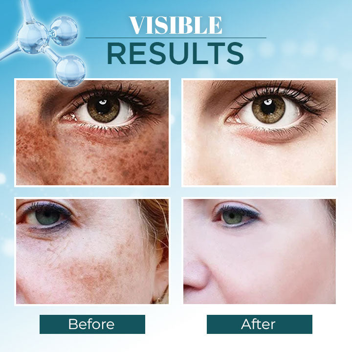 Triple-Active Brightening Dark Spot Remover