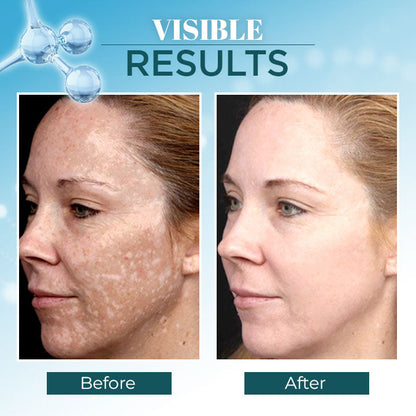 Triple-Active Brightening Dark Spot Remover