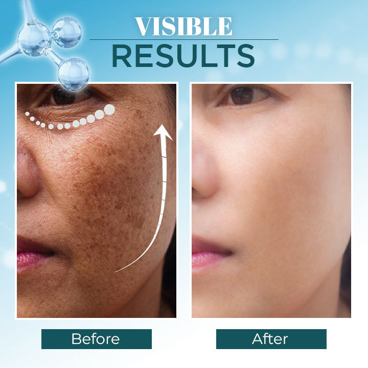 Triple-Active Brightening Dark Spot Remover