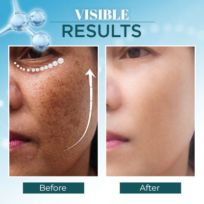 Triple-Active Brightening Dark Spot Remover