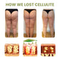 Cellulite Reduction Patches