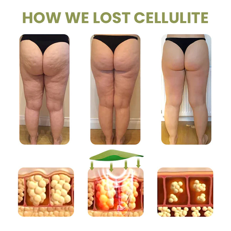 Cellulite Reduction Patches