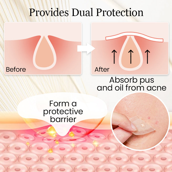 Hydrogel Acne Patch