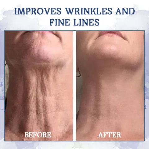 LOVILDS® Advanced Firming & Wrinkle-Reducing Cream