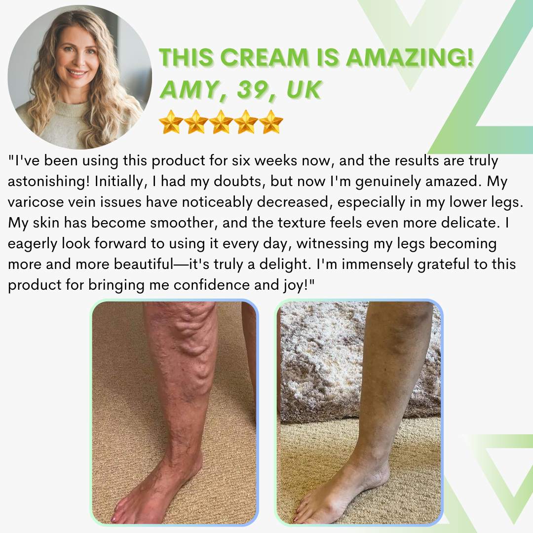 Varicose Vein Cream