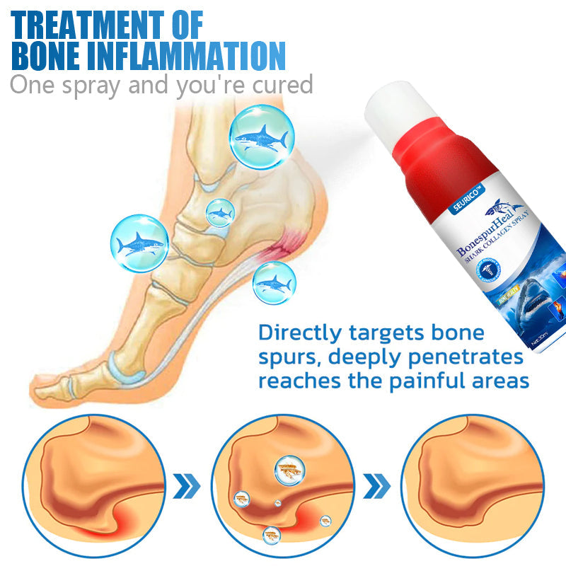 Shark Collagen Spray: The Ultimate Solution for Bone Spur Relief and Joint Mobility!