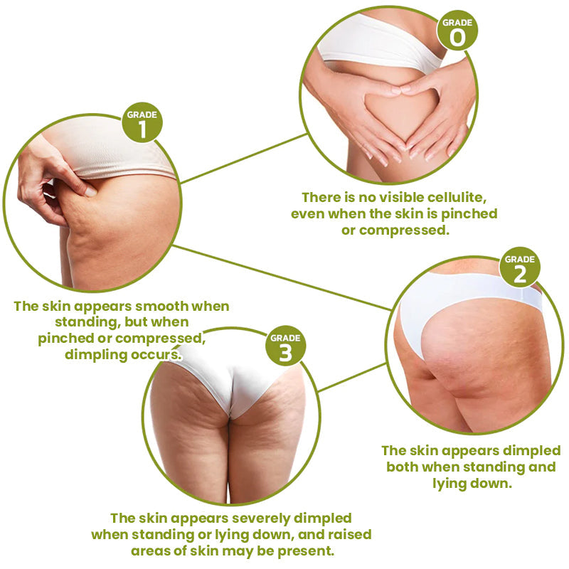 Cellulite Reduction Patches