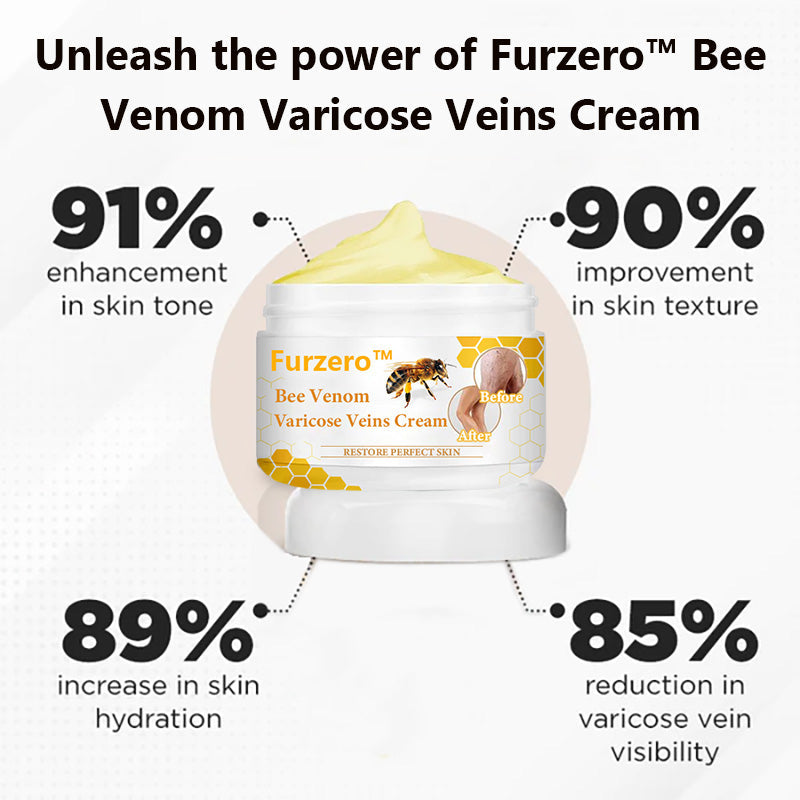 Bees Venom Varicose Veins Cream