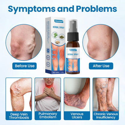 Veinelle® Herbal Spray – Clinically Proven to Visibly Fade Varicose & Spider Veins in Just 7 Days