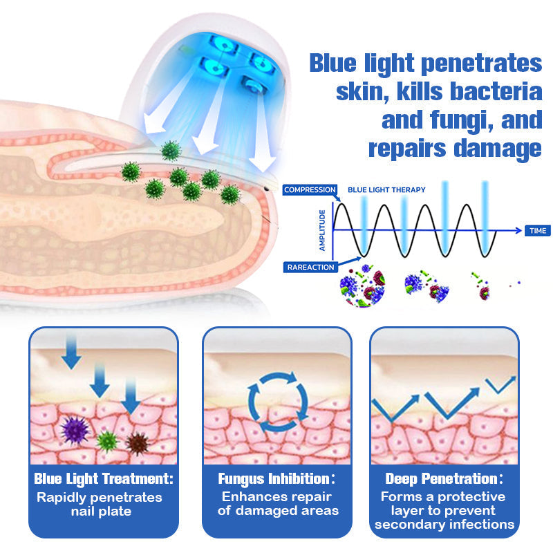 Nail Fungus Cleaning Laser Relief Device