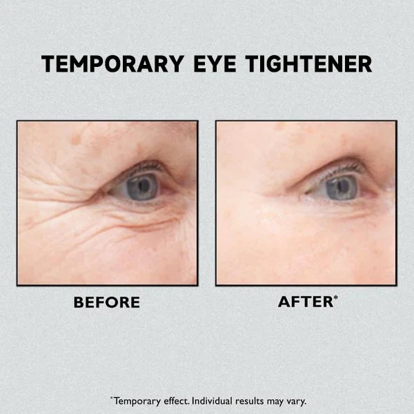 Clinical SkinCare Instant Eye Tightener