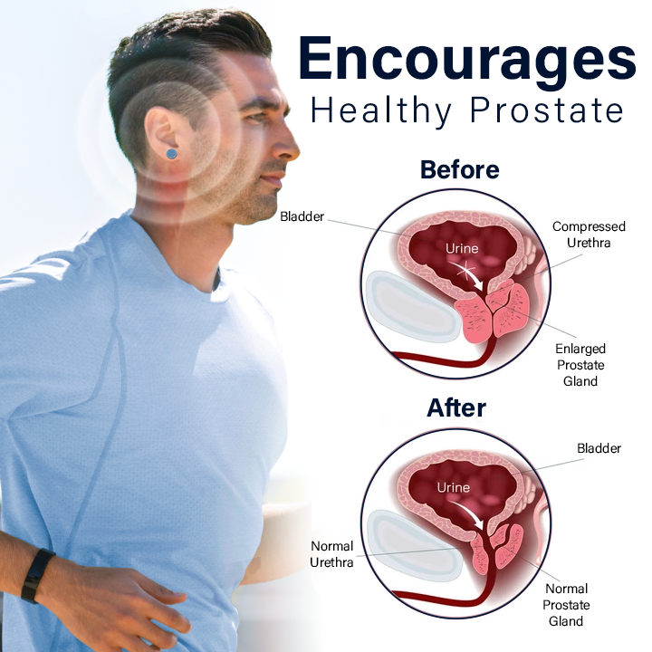 Fivfivgo™ Magnetherapy Prostate Wellness Earring