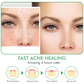 Overnight Hydrocolloid Acne Clear Patches