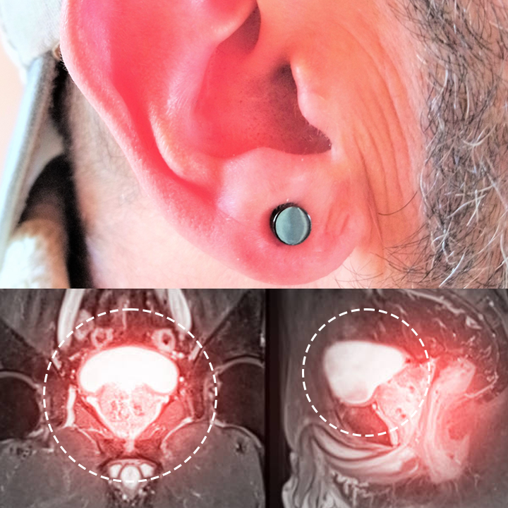 Fivfivgo™ Magnetherapy Prostate Wellness Earring