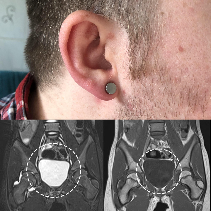 Fivfivgo™ Magnetherapy Prostate Wellness Earring