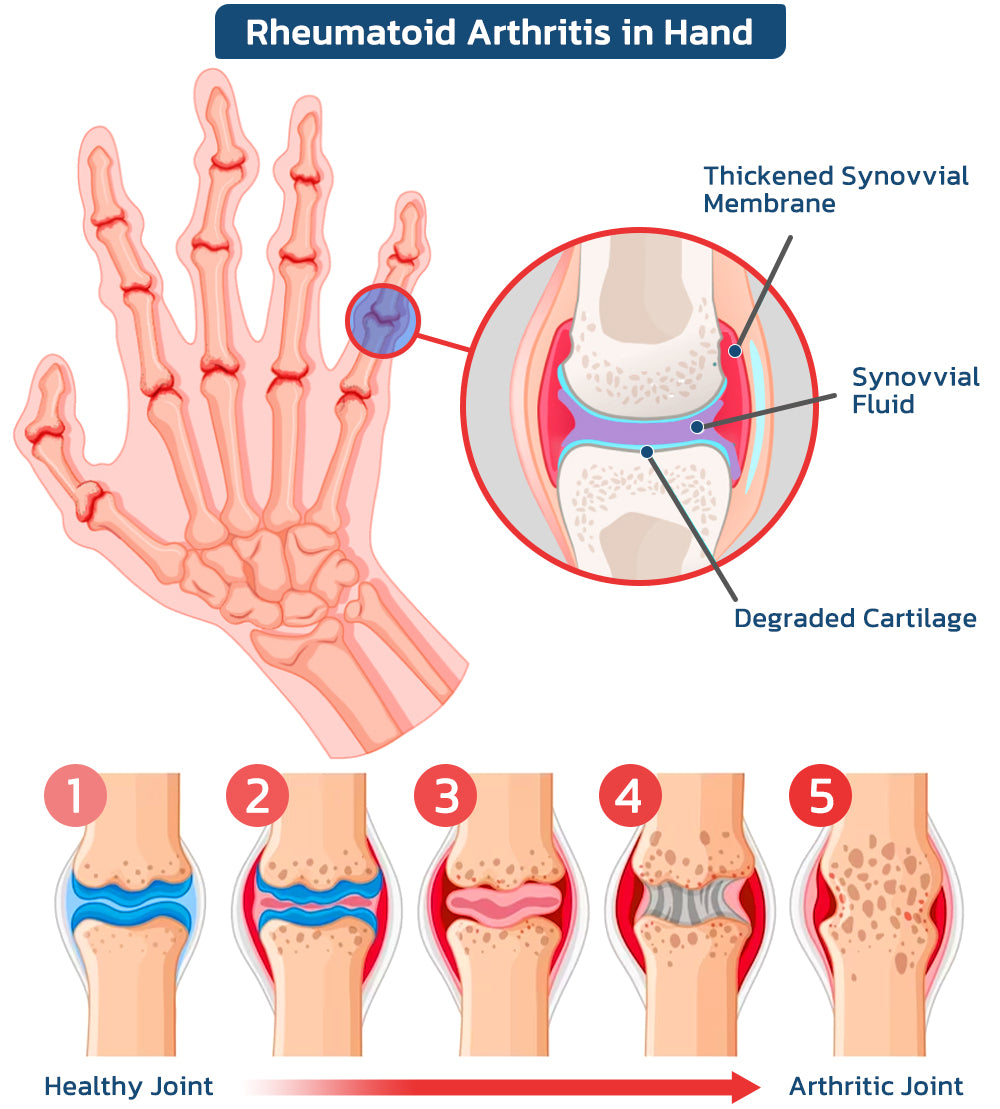 Fivfivgo™ Bee Venom Advanced Joint and Bone Therapy Cream