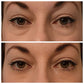 Clinical SkinCare Instant Eye Tightener