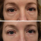 Clinical SkinCare Instant Eye Tightener