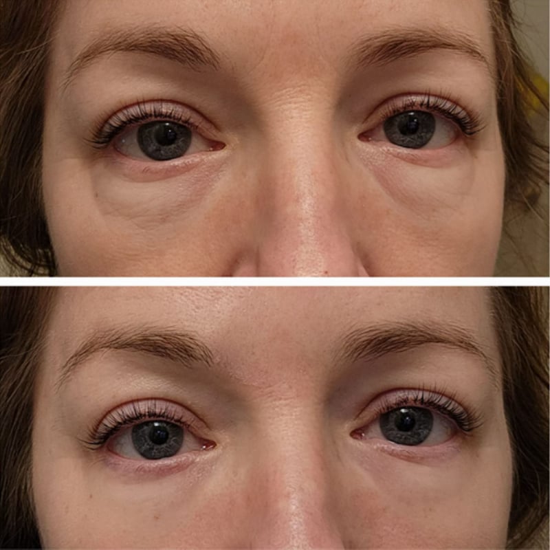 Clinical SkinCare Instant Eye Tightener