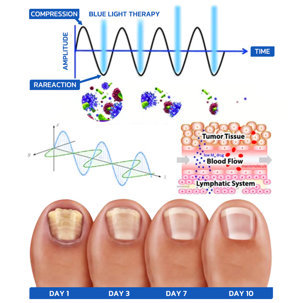 Nail Fungus Cleaning Laser Relief Device