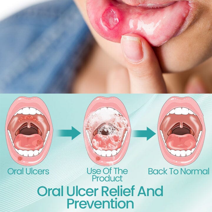 RadiantSmile Oral Rinse