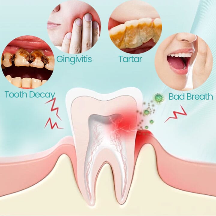 RadiantSmile Oral Rinse