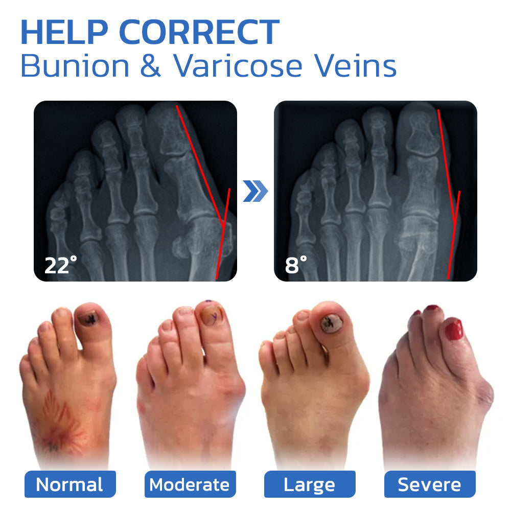 Anti-Bunion and Vein Health Socks