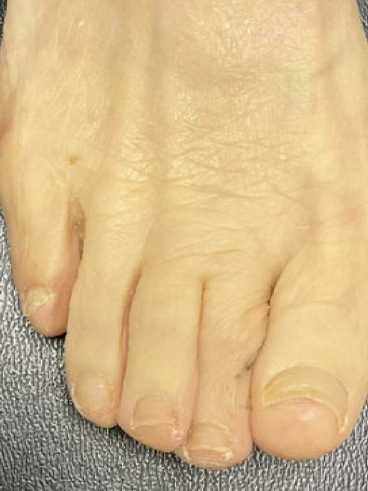 After image for Catherine