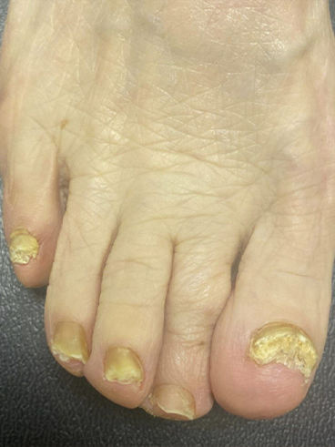 Before image for Catherine