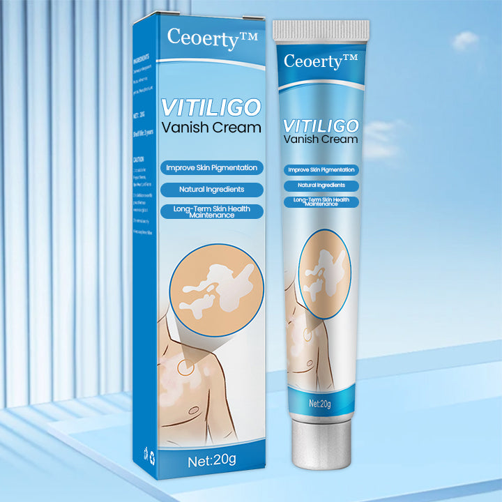 Vitiligo Vanish Cream