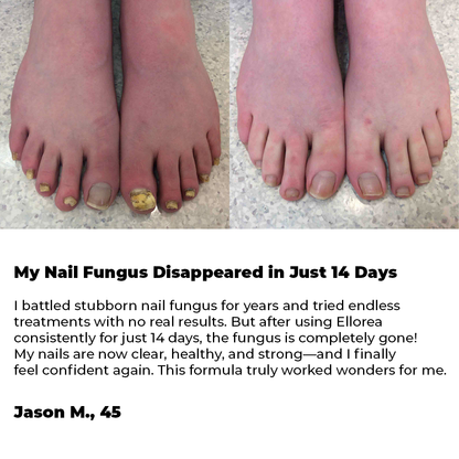 Anti-Fungal Odor Bee Venom Spray