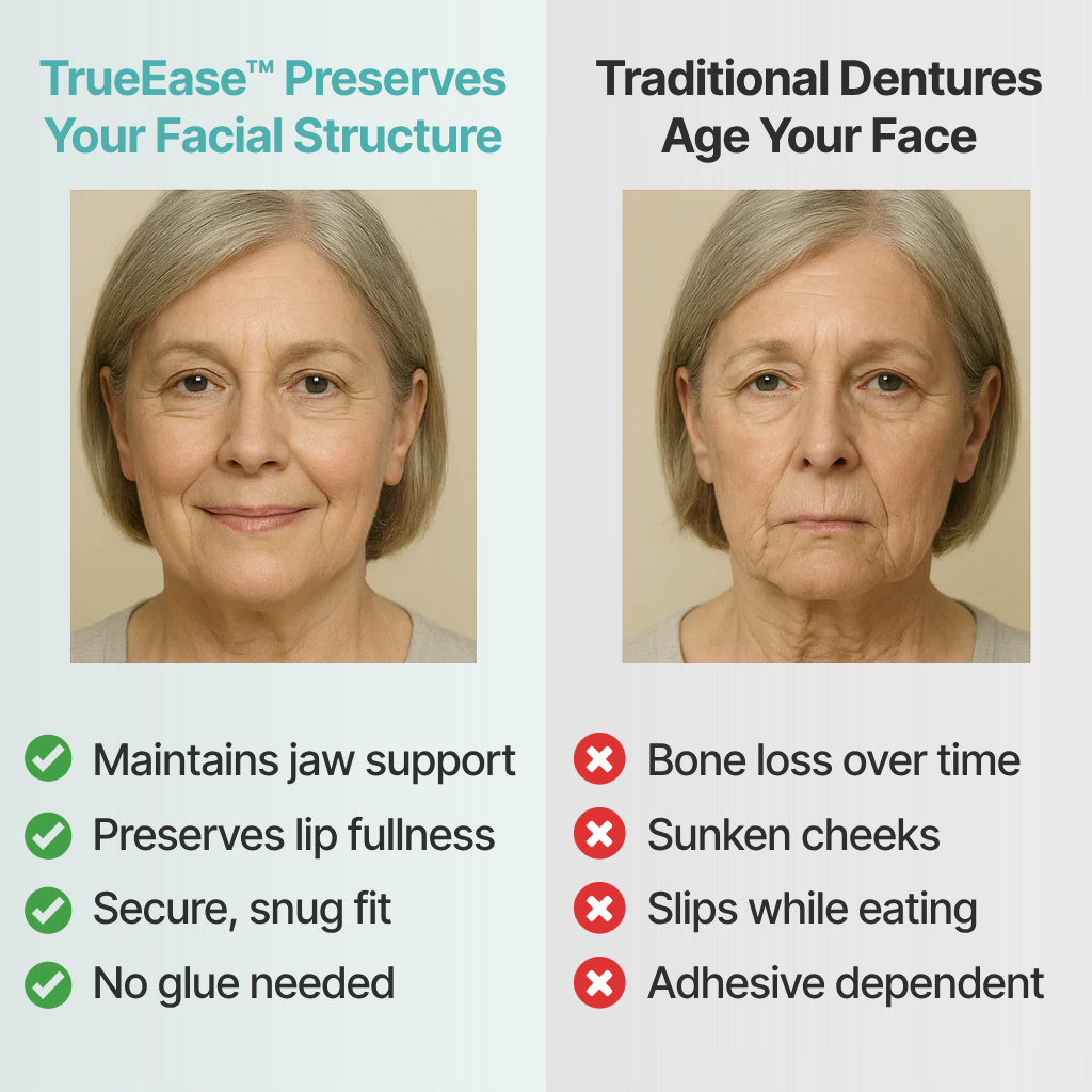 TrueEase™ Custom-Fit Functional Dentures — Perfectly Fitted in Minutes at Home