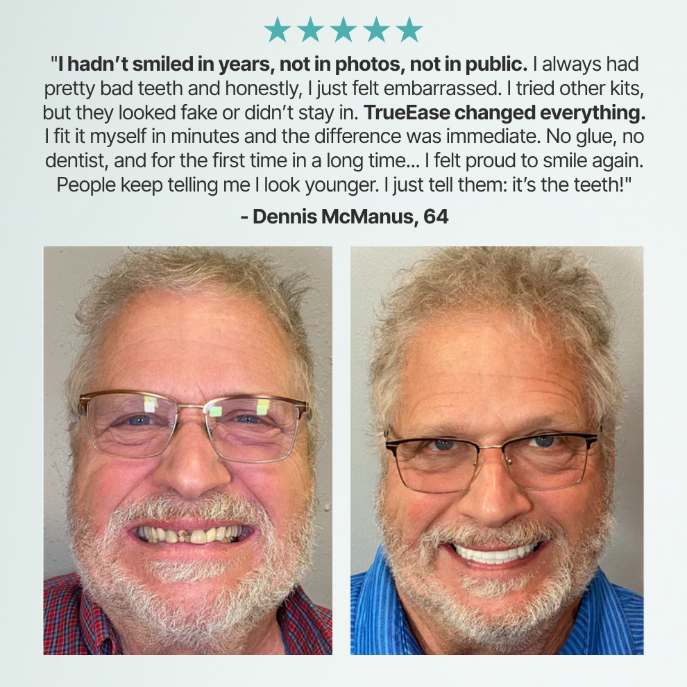 TrueEase™ Custom-Fit Functional Dentures — Perfectly Fitted in Minutes at Home