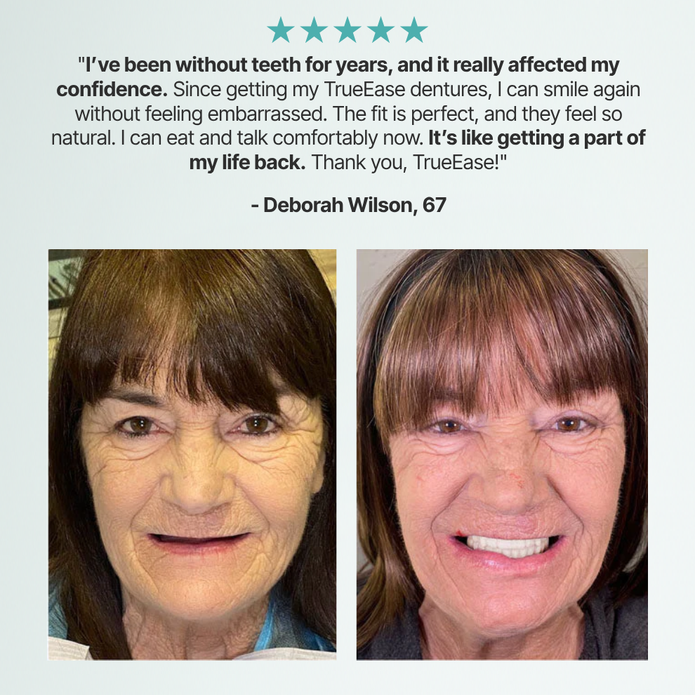 TrueEase™ Custom-Fit Functional Dentures — Perfectly Fitted in Minutes at Home