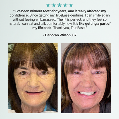 TrueEase™ Custom-Fit Functional Dentures — Perfectly Fitted in Minutes at Home